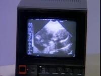 Click to watch 'The One With The Sonogram...' (popup) Friends